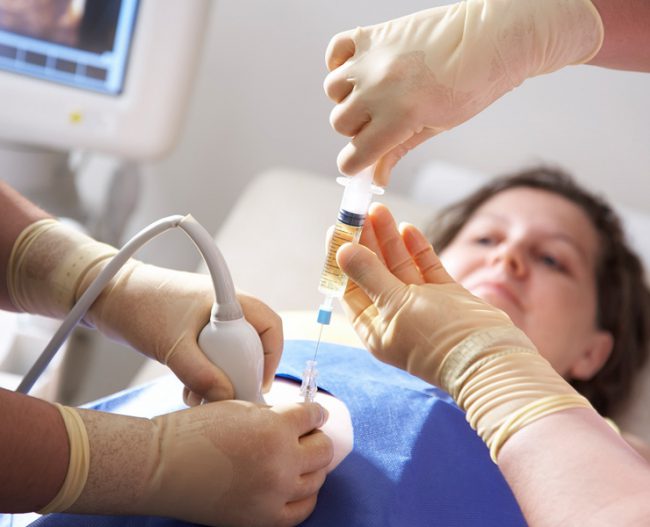 girisimler-amniosentez